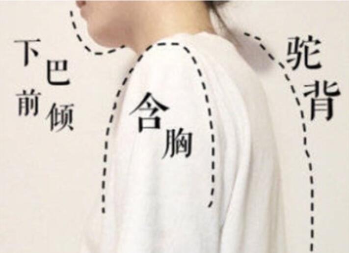 南寧美容學(xué)校：堅(jiān)持一個(gè)月，駝背變直背