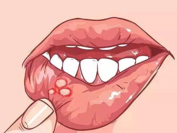 身體發(fā)出信號(hào)，你該補(bǔ)維生素了