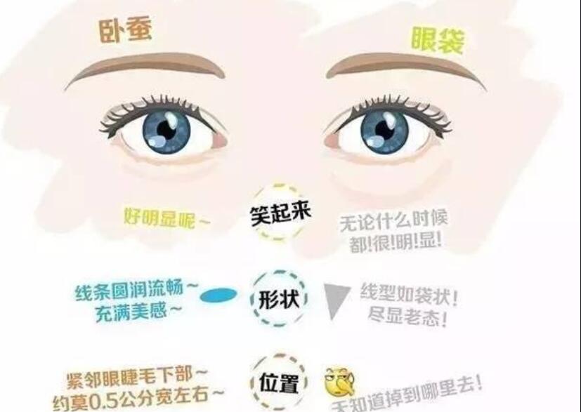 眼袋還是臥蠶，快來(lái)學(xué)辨別的方法