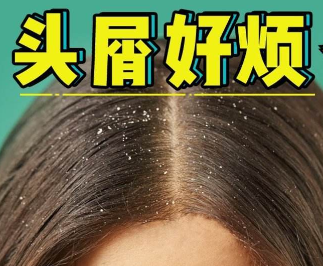 南寧正規(guī)美發(fā)培訓學校分享：冬天如何減少頭屑過多？