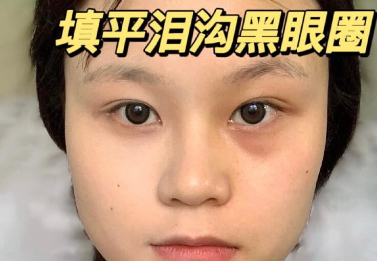 填平淚溝黑眼圈教程，廣西南寧化妝學(xué)校分享