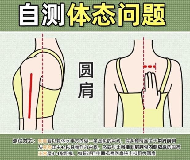 你真的是駝背嗎？廣西美容美體學校教你自測